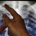 maharashtra-health-department-integrates-tb-screening-into-medical-faculty-household-adoption-programmes