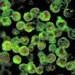 kerala-stories-extra-amoebic-meningoencephalitis-instances,-together-with-a-dying