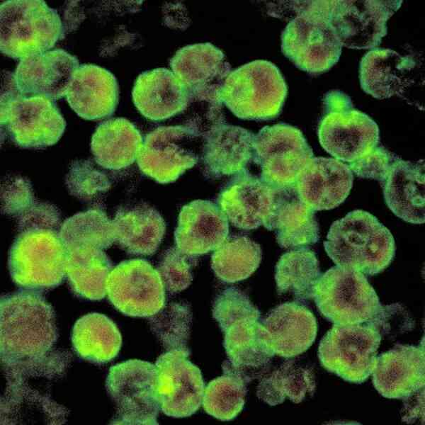kerala-stories-extra-amoebic-meningoencephalitis-instances,-together-with-a-dying